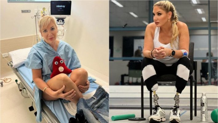 O femeie a suferit 47 de operații și și-a pierdut ambele picioare de la o mușcătură de țânțar