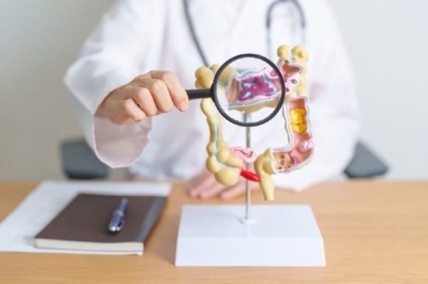 Riscul de cancer de colon crește la cei născuți după 1990. Cum poate fi prevenit