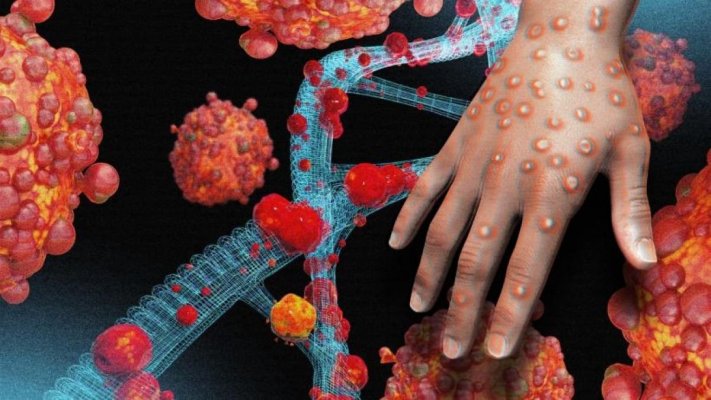 Avem motive de îngrijorare: Mpox, declarată urgență globală de către OMS