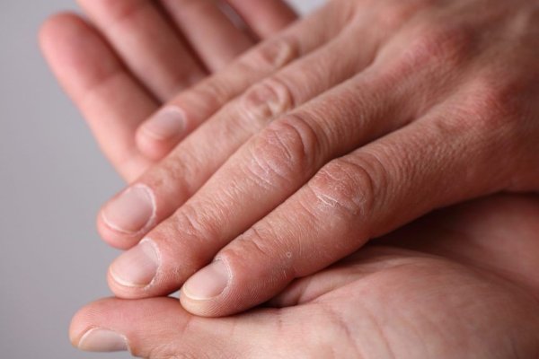 De ce ai senzația, uneori, că îți ard mâinile: Cauzele acestui simptom