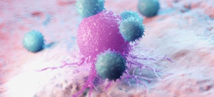 Anumite celule imunitare din intestin ar putea duce la dezvoltarea cancerului
