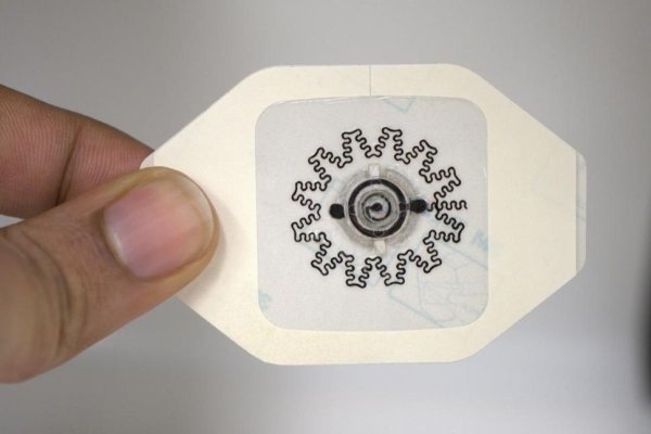 Analize medicale la un click distanță: Cum funcționează plasturele inteligent?