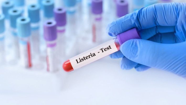 Ce este Listeria, bacteria care poate provoaca toxiinfecție alimentară