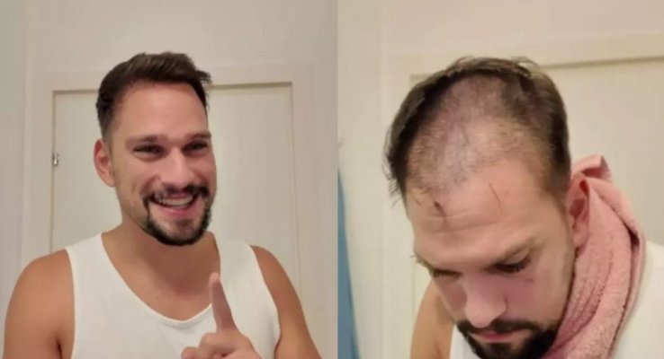 Motivul pentru care Vlad Gherman s-a tuns la zero