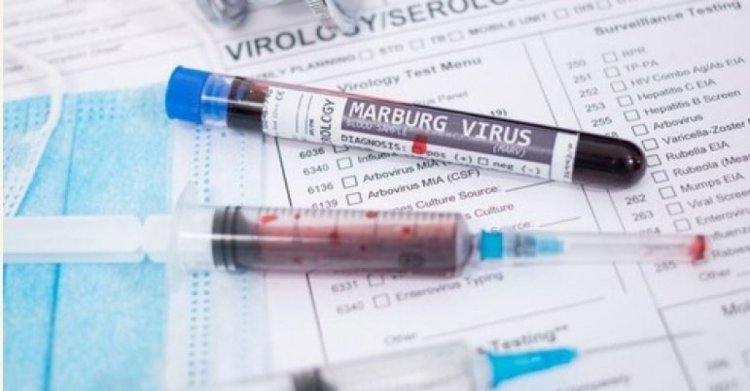 11 oameni au murit din cauza virusului Marburg în Rwanda