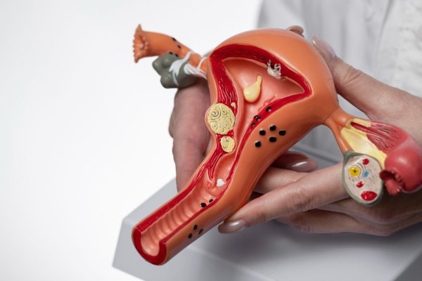 Dispozitivele de contracepţie cu eliberare de hormoni pot creşte riscul de cancer la sân 