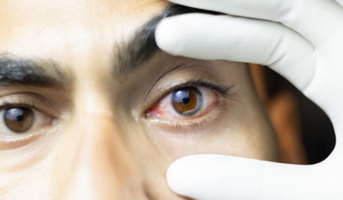 Corneea artificială hibrid, o invenţie care dă speranţe oamenilor că îşi vor recăpăta vederea