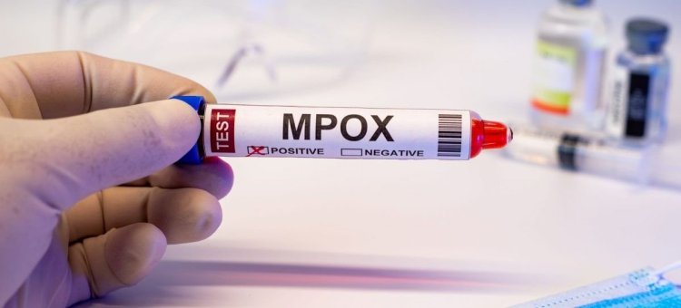 OMS a aprobat primul test destinat diagnosticării mpox