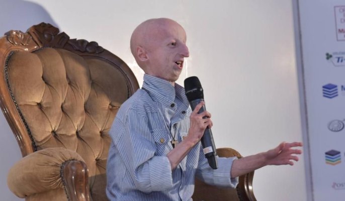 Sammy Basso, om de ştiinţă şi simbol al luptei împotriva progeriei, boală de care suferea, a murit la 28 de ani