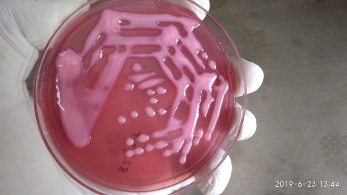 Descoperire fabuloasă: A fost găsit un virus care poate ucide superbacteria Klebsiella