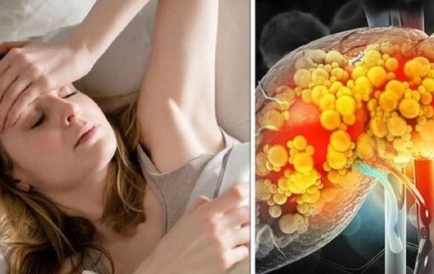 5 semne de avertizare care îți arată că ai probleme grave cu ficatul