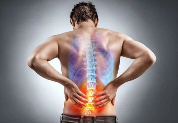 Medic: Hernia de disc, o consecință a sedentarismului și a efortului fizic excesiv