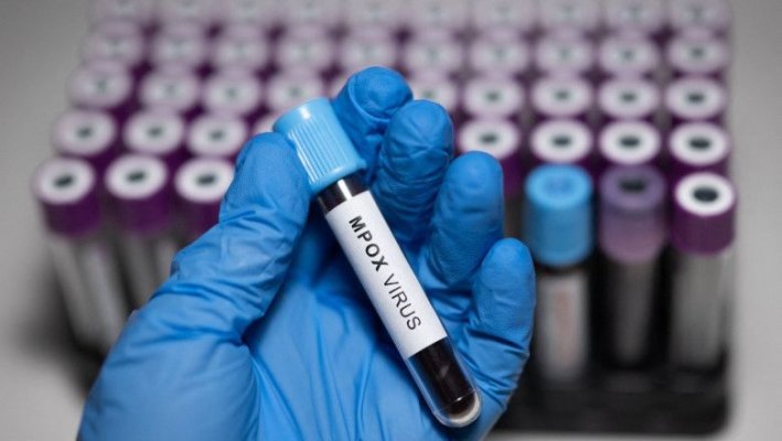 Apar noi cazuri de infecţie cu varianta mai periculoasă de mpox. Țările care au confirmat îmbolnăviri