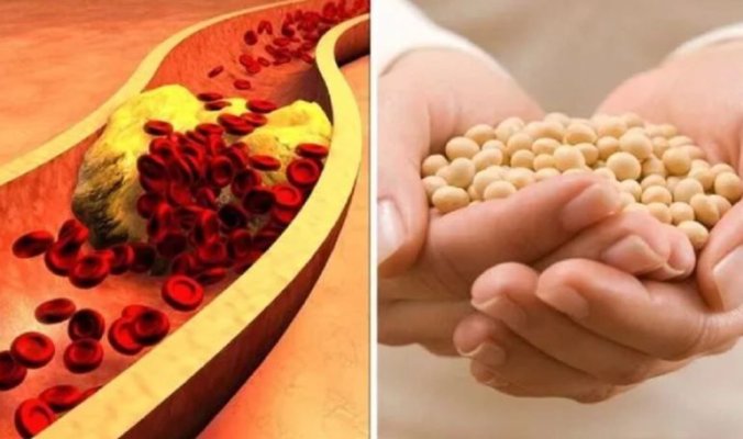 5 superalimente de iarnă care curăță arterele înfundate în mod natural