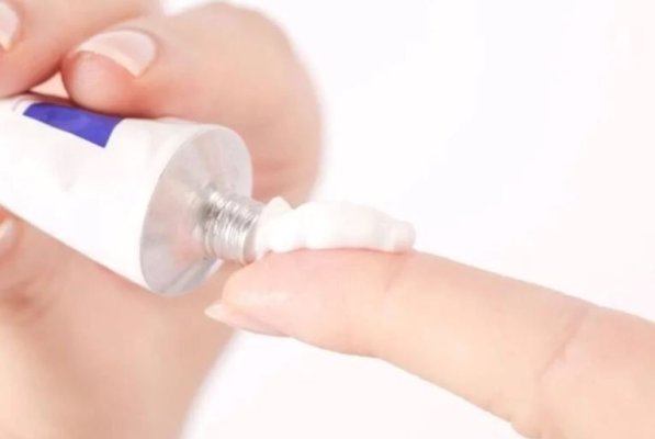 O femeie a murit de la o cremă pentru hemoroizi. Ce conținea acesta