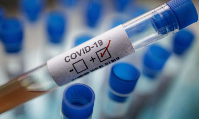 Studiu referință despre COVID-19 publicat de un medic francez, invalidat