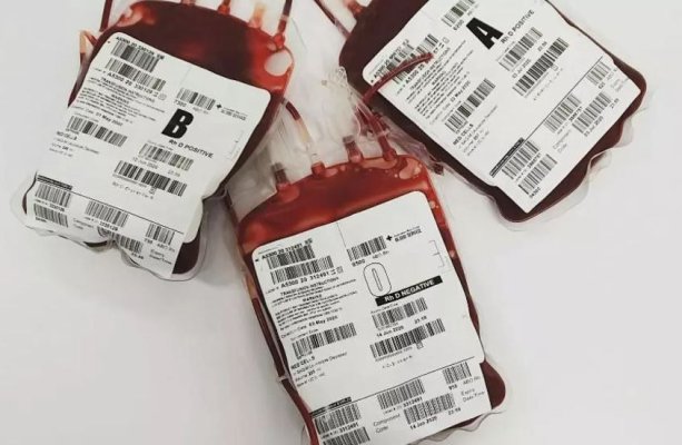 Primele simptome ale anemiei. De ce trebuie tratată această afecțiune