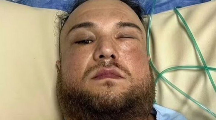 Bărbatul din Năvodari care a fost înjunghiat, în timp ce se afla în vacanță în Egipt, a fost repatriat