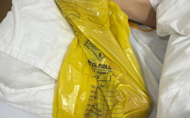 Scandal la un spital din țară, după ce piciorul unui pacient imobilizat la pat a fost băgat într-un sac de gunoi