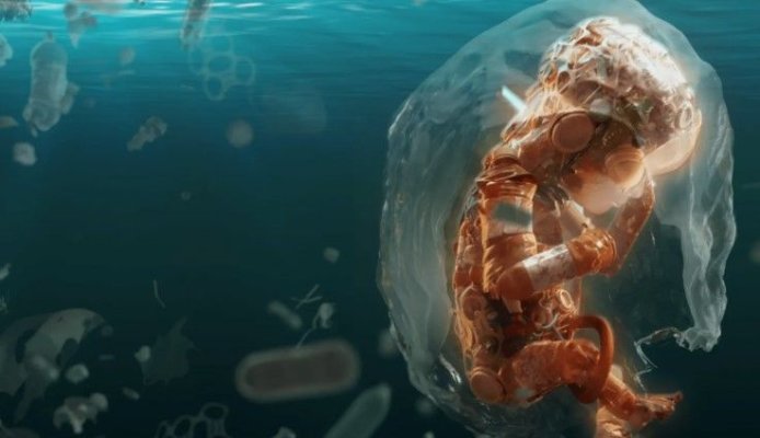 Studiu: Particule minuscule de plastic pot pătrunde în creier, unde blochează arterele cerebrale