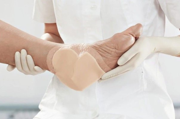 Cum să îngrijești corect piciorul diabetic și să previi apariția ulcerațiilor