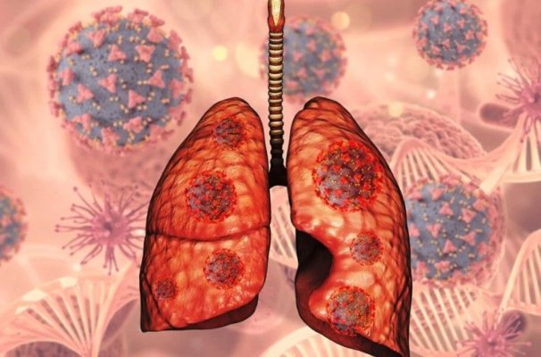 Cum afectează fibroza chistică alte organe în afară de plămâni și pancreas