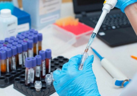 Analizele periodice pot face diferența între un diagnostic precoce și o boală descoperită prea târziu