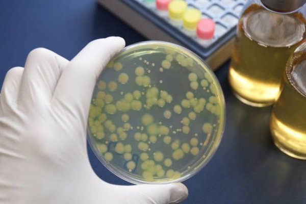 Apa de la un Spital de Pediatrie din țară, contaminată cu bacteria Pseudomonas aeruginosa