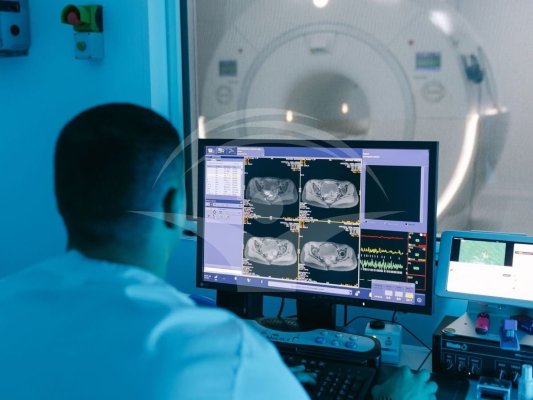 RMN-ul ultra-puternic detectează „ascunzătorile“ epilepsiei și deschide calea spre vindecare chirurgicală