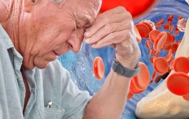 Semne tăcute ale arterelor înfundate. Ce să faci urgent pentru a le curăța
