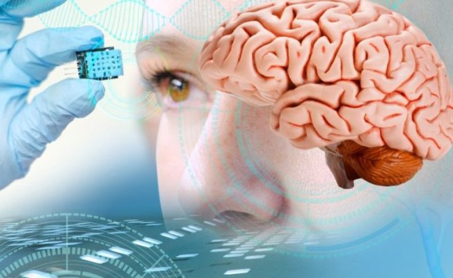 Premieră medicală: un implant cerebral revoluționar transformă gândurile în cuvinte, în timp real