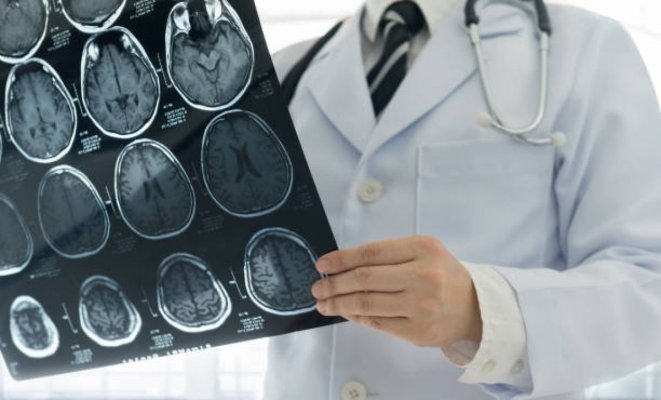 Cum te ajută degetele de la picioare să recunoști pericolul unui atac vascular cerebral