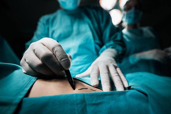 Tumoare gigant, de mărimea unui copil, extirpată din piciorul unui bărbat
