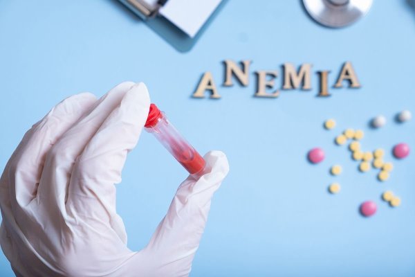 Inteligența artificială, aliat împotriva anemiei. Cercetătorii americani lansează o aplicație inovatoare
