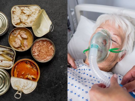 O femeie, diagnosticată cu botulism, după ce a mâncat conserve făcute acasă