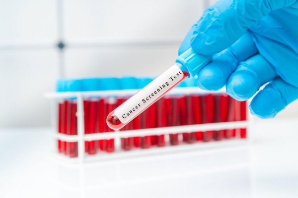 Societatea Română de Dermatologie continuă seria campaniilor de prevenţie 'Euromelanoma'