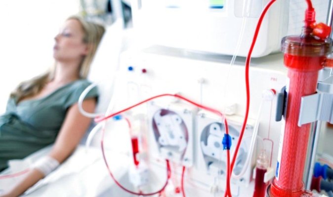 O femeie a mâncat spuma sintetică din scaunul pe care stătea, în timp ce făcea dializă. Cum explică medicii cazul unic