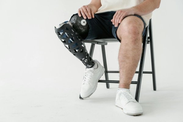 Descoperire-fenomen: Un medicament anti-acnee ar putea regenera membrele amputate
