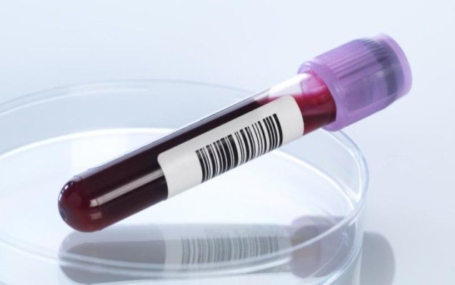 Testul de sânge revoluționar care detectează cancerul cu mulți ani înainte de apariția simptomelor