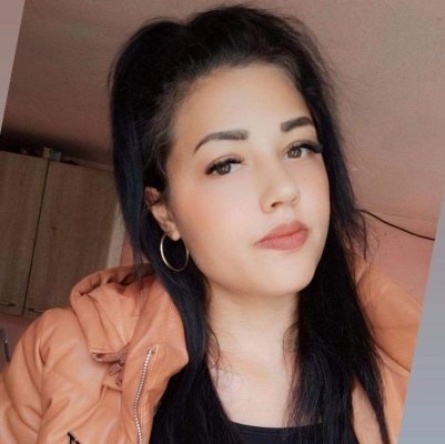 Anda, fata incendiată de fostul iubit, a cerut ajutor la TV. A făcut tot ce a fost posibil să își apere viața