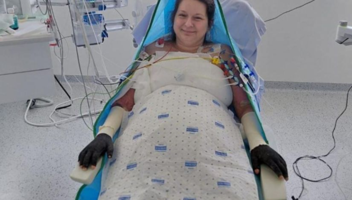 Care este starea Laviniei, pacienta cu arsuri infectată la Floreasca și transferată în Belgia