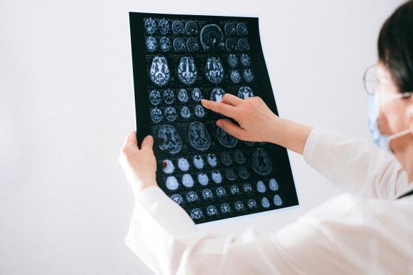 Vitamina care are un mare impact asupra creierului: Ajută la menținerea volumului materiei cenușii