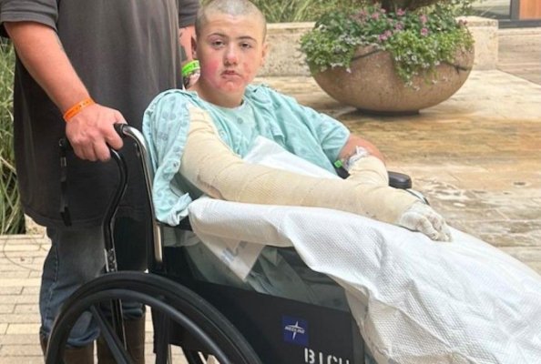 Un băiat de 12 ani a ajuns la spital cu arsuri grave, după ce a încercat un experiment văzut pe TikTok