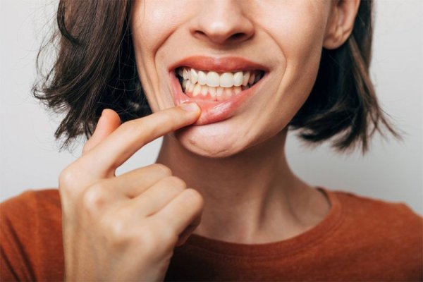 Remedii naturale pentru afte bucale: De la apă sărată la turmeric, secretele vindecării blânde