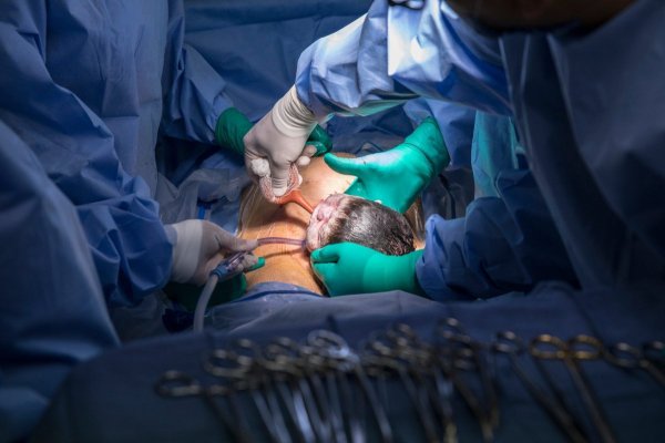 Soluție și pentru România? Turcia sancţionează peste 100 de ginecologi care efectuau constant cezariene