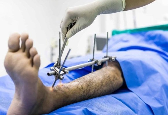 Un fenomen periculos câștigă teren în rândul turiștilor medicali care recurg la o intervenție riscantă și dureroasă