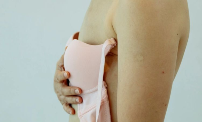 Medic: Sunt paciente cu cancer de sân care fac o erupţie de tip herpes zoster necrotic la nivel mamar