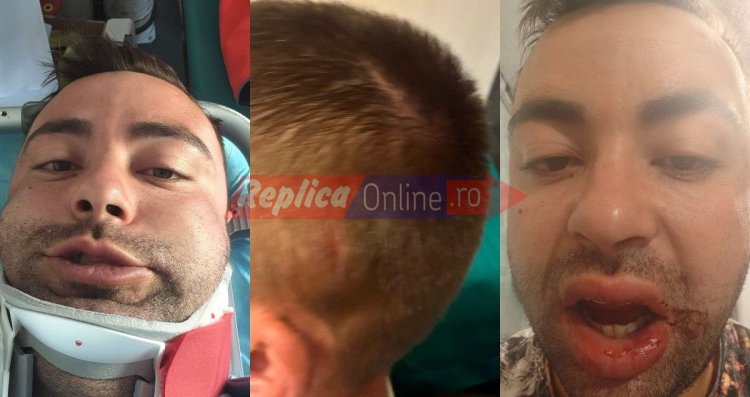 Doi frați au fost bătuți măr cu bâte și sticle de șase persoane, în satul Coslugea. Video