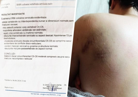 O femeie din Constanța care a apelat la un „terapeut“... a ajuns pe masa de operație, cu dureri cervicale groaznice 
