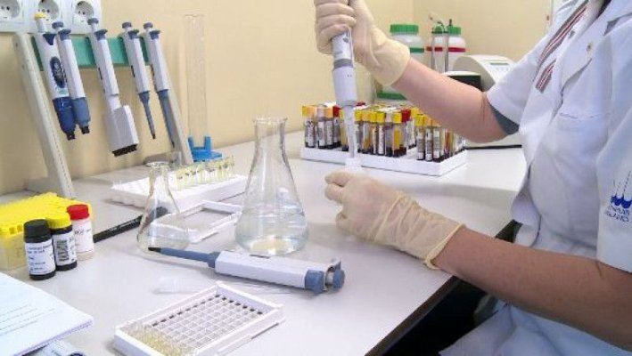 Un caz clinic sugerează o potenţială cale de eliminare a celulelor infectate cu HIV din organism